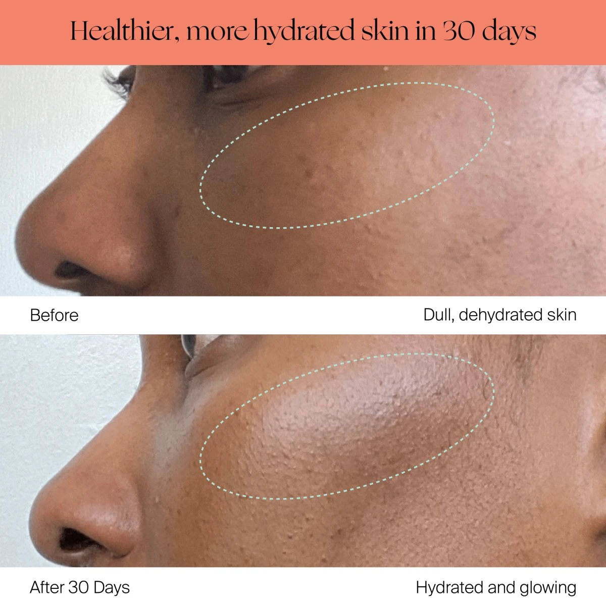 Canopy Large Room Humidifier: Hydrate Plants, Skin & Space - Image 9