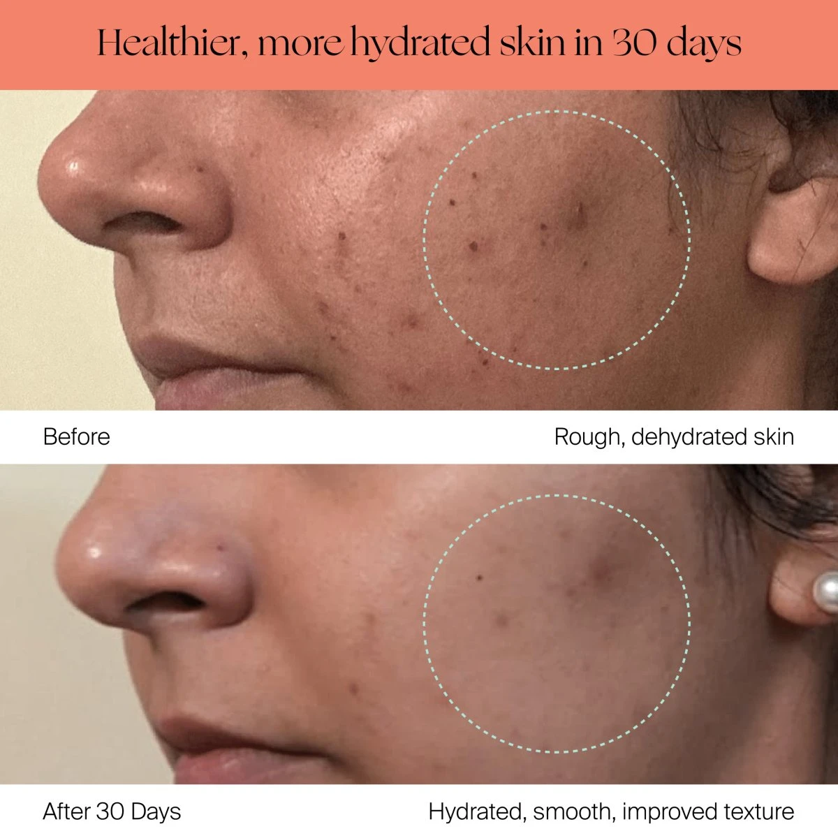 Canopy Large Room Humidifier: Hydrate Plants, Skin & Space - Image 10